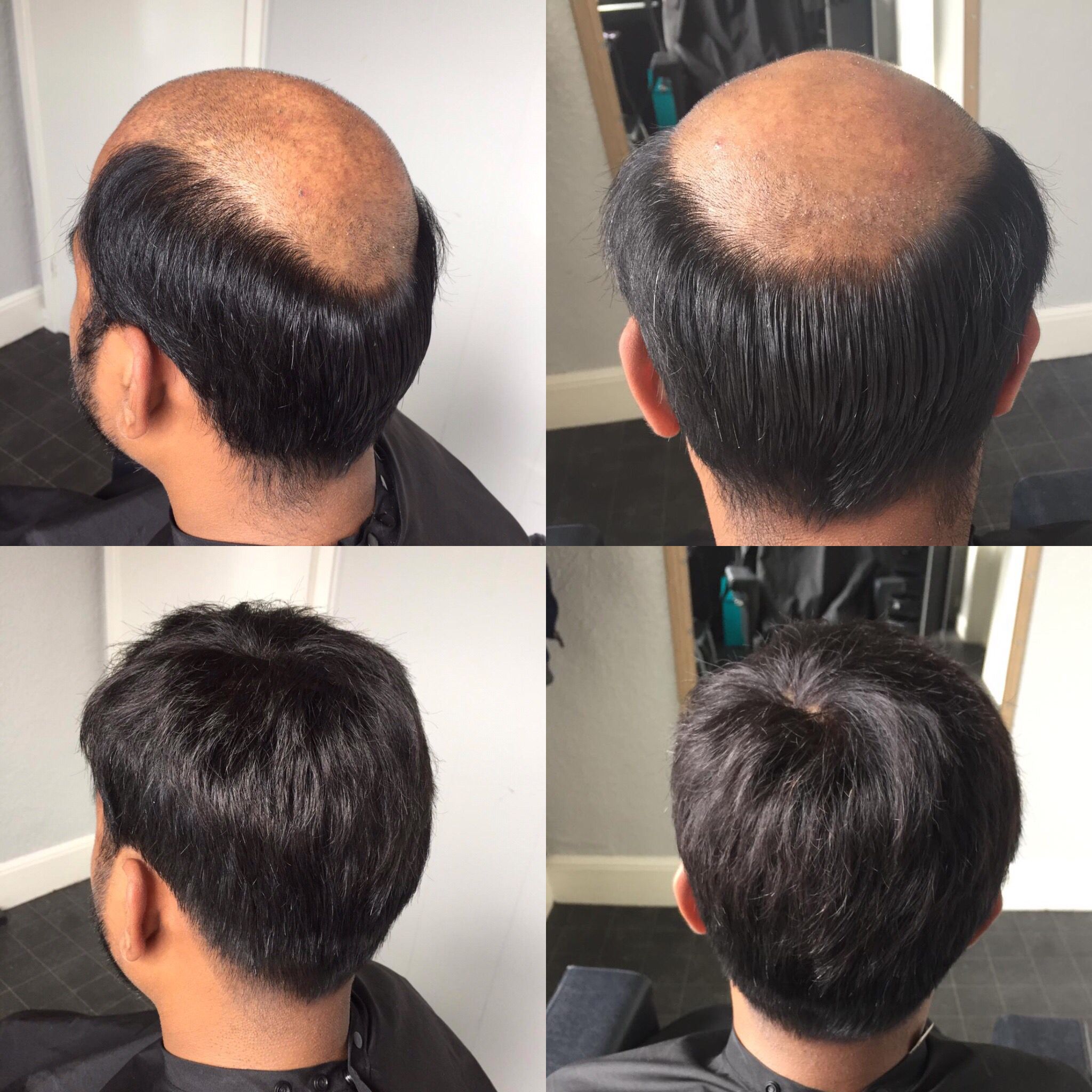 Hair Extensions