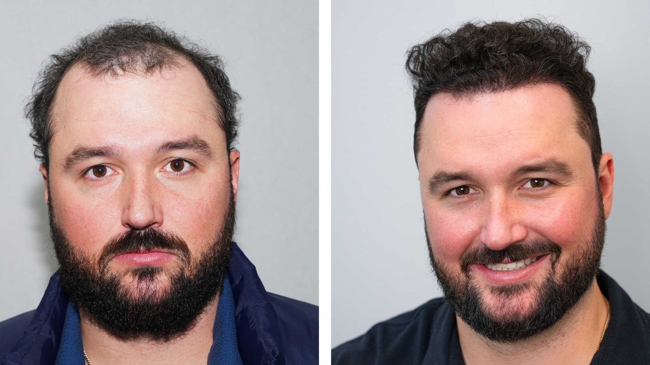 Before and After 1