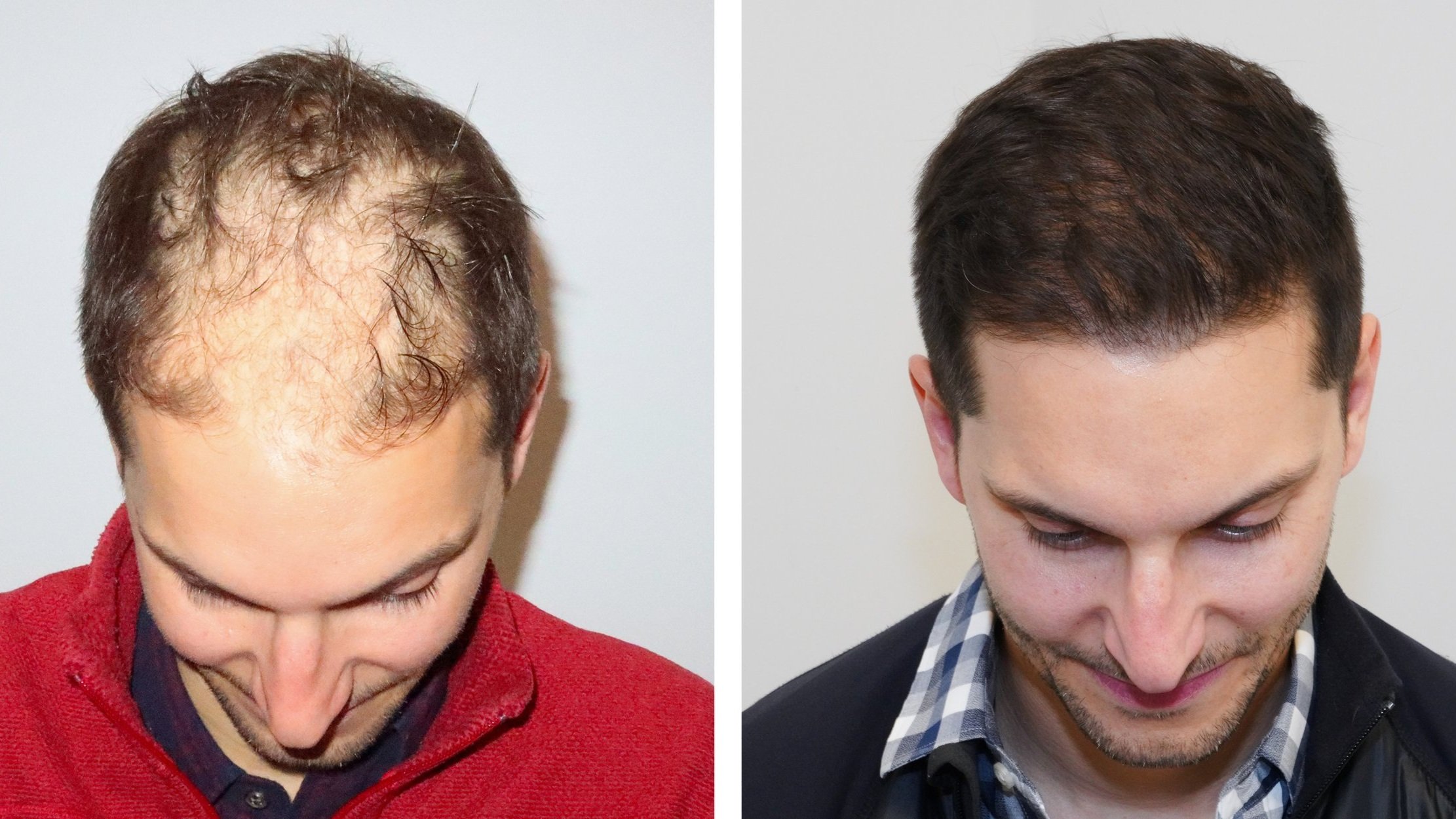 Before and After 3